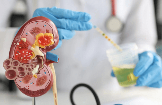 Kidney Failure - Rehman healthcare Centre